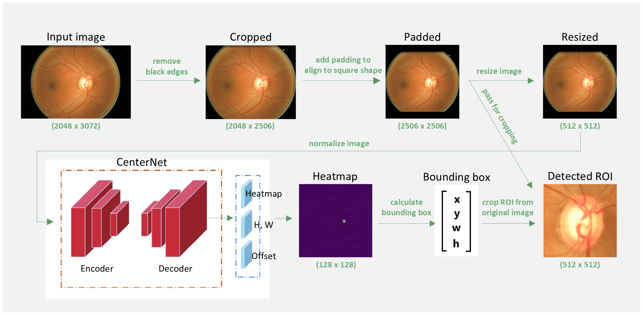 Glaucoma Segmentation